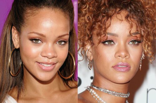 Has Rihanna had Cosmetic Surgery?