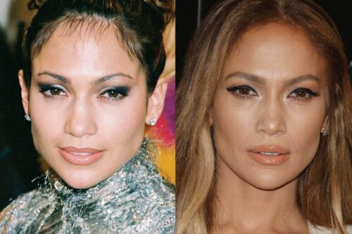 Has Jennifer Lopez Had Cosmetic Surgery