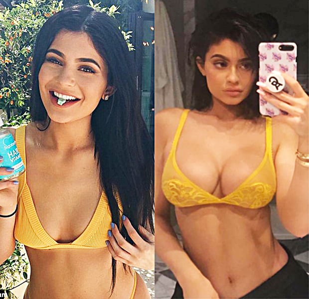 Does This Prove Kylie's had a Boob Job?