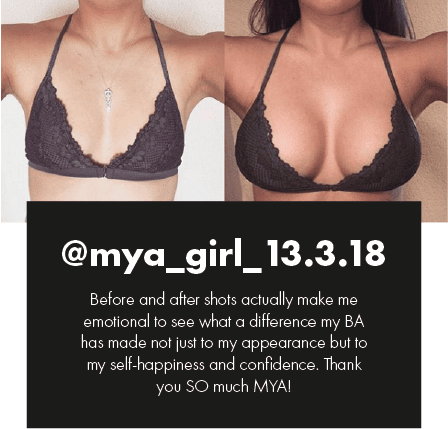 How Much Is A Boob Job Breast Augmentation Cost Uk Mya