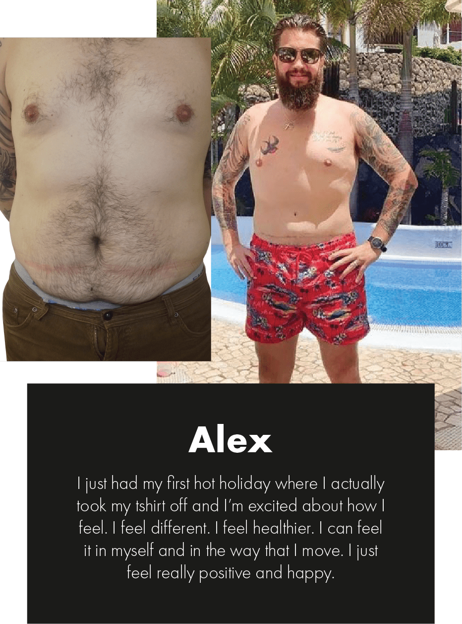 male tummy tuck recovery