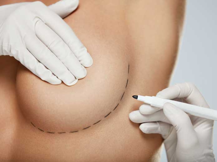 Potential Risks & Complications with Breast Surgery