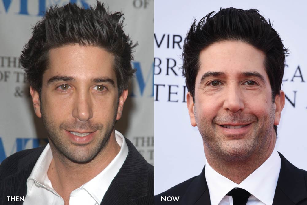 Have the Friends cast had cosmetic surgery?